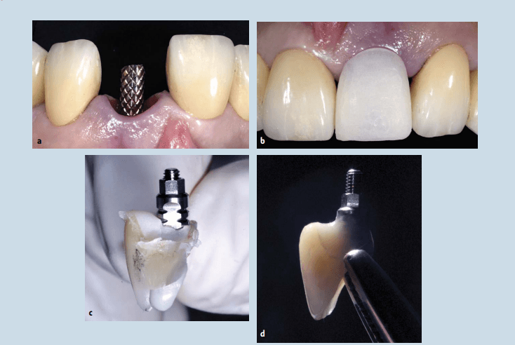 teeth xray